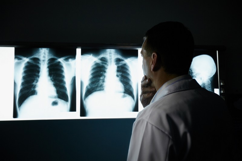 Ученые смогут диагностировать рак легких с помощью анализа дыхания