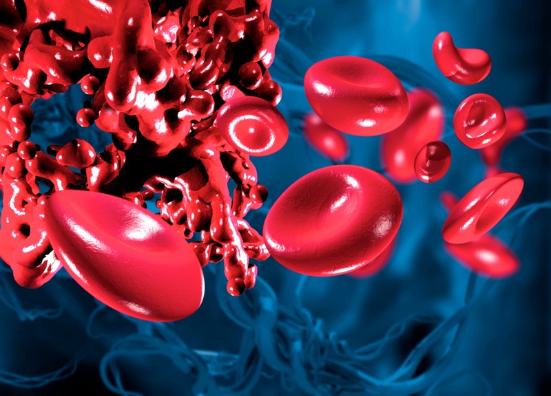 Шаг вперед в борьбе с инсультом: ученые Университета ИТМО предлагают лечить тромбоз с помощью магнитоуправляемой жидкости